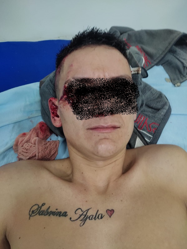 Assaltantes levam carro e na fuga batem em residência em Ponta Porã