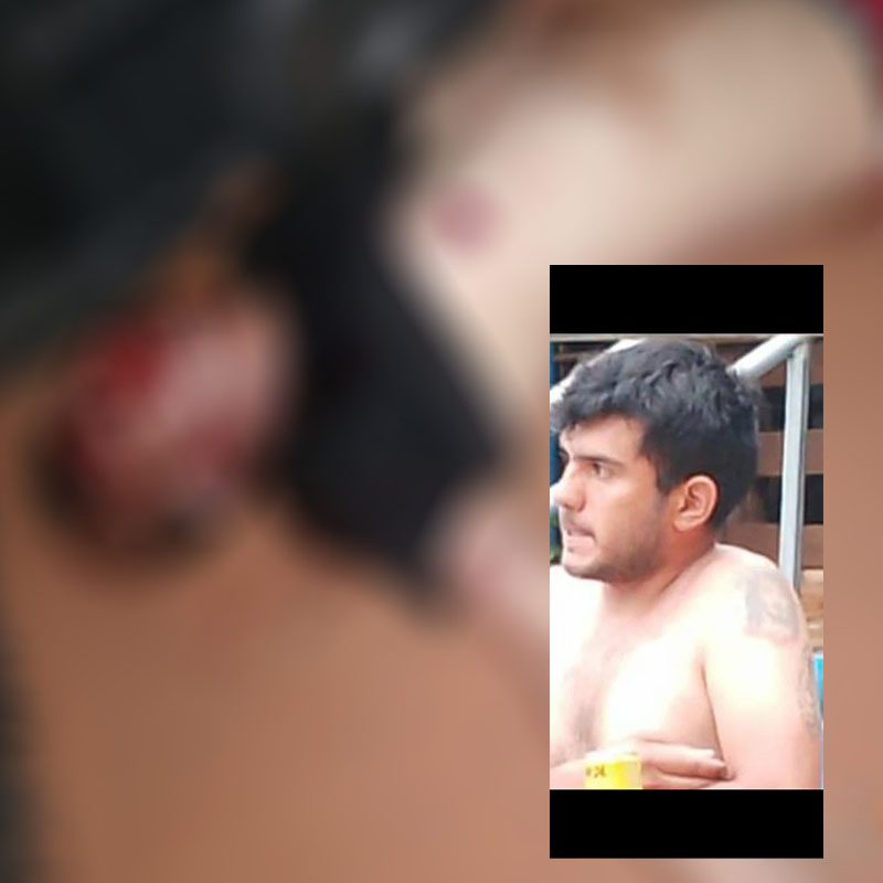 "Sicário" procurado por homicídio em estabelecimento comercial é preso no Hospital Regional da fronteira