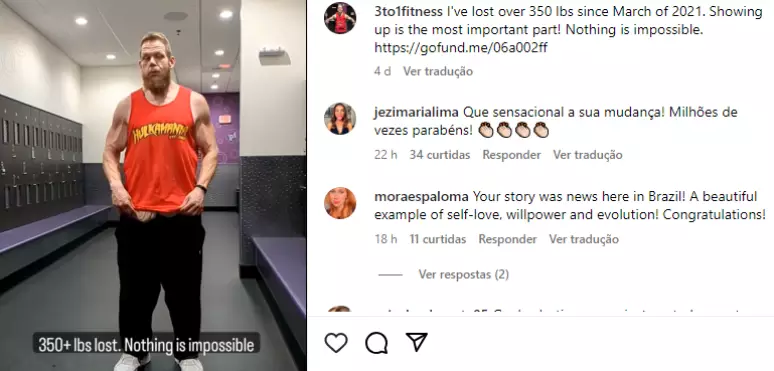 Homem perde 163 kg e pede ajuda para cirurgia de retirada de excesso de pele